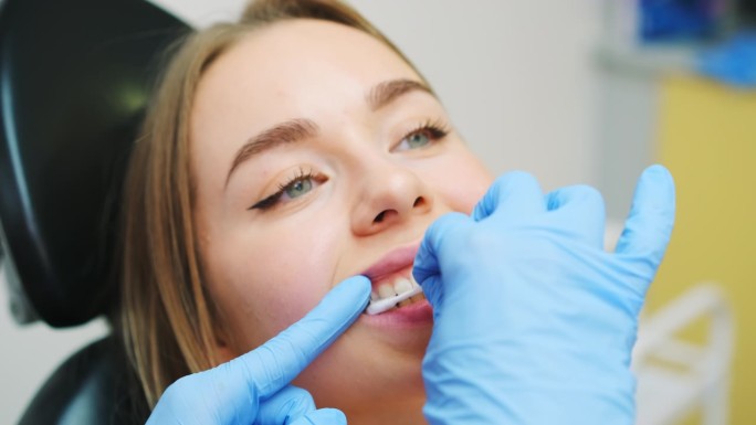 牙医在牙齿美白后使用再矿化凝胶
