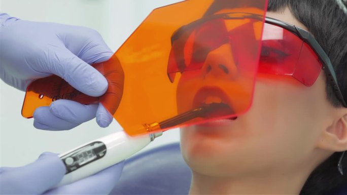 牙医在固定时照射紫外线光聚合物密封件