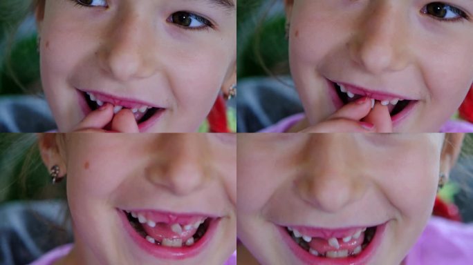 孩子摇了摇乳牙，露出了一个没有牙齿的微笑。在儿童时期把牙齿换成磨牙