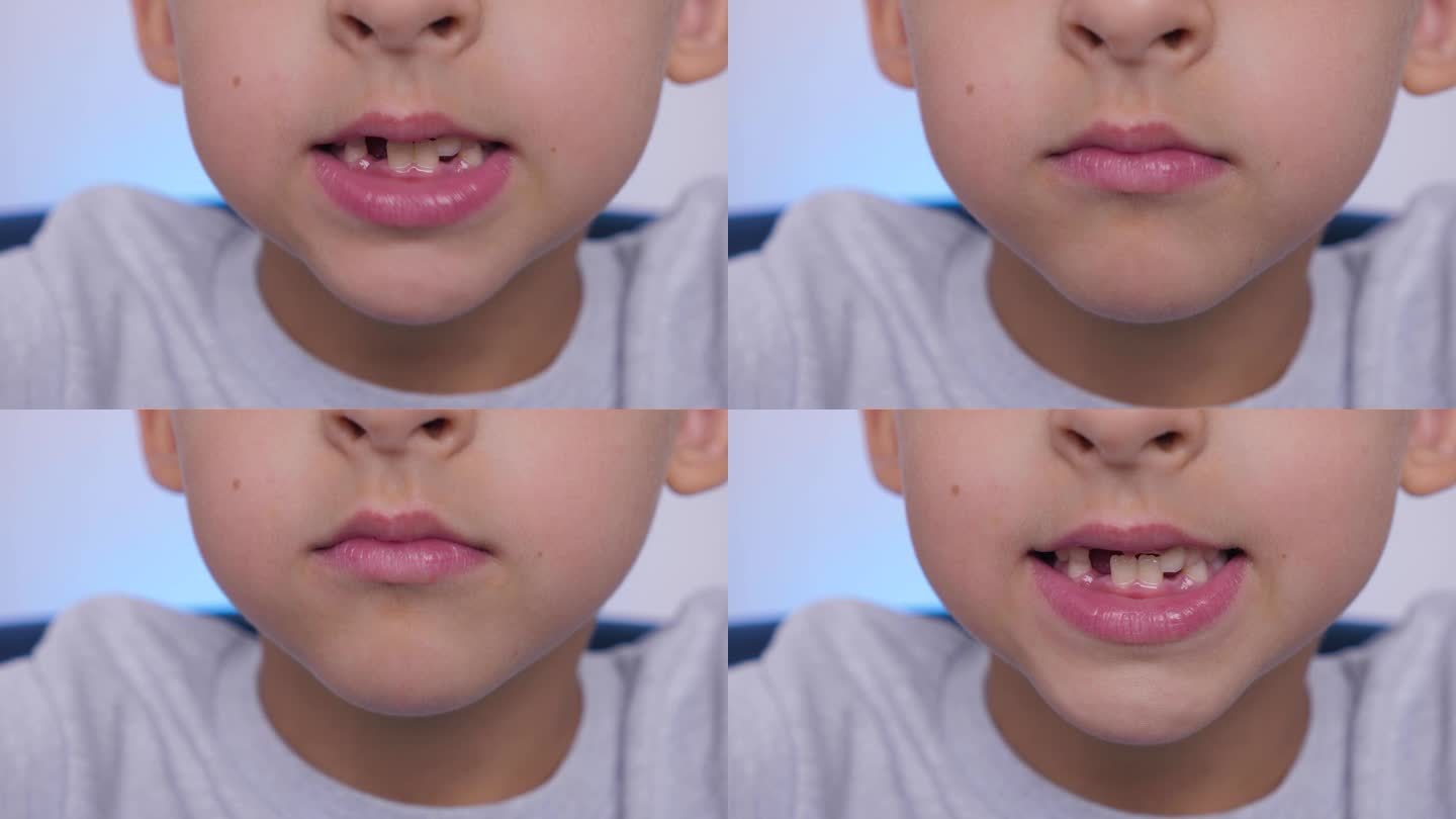 近口小孩掉了一颗乳牙。更换恒换牙、无牙微笑、牙龈破洞。儿童牙科概念。男孩穿着一件灰色t恤，对着镜头微