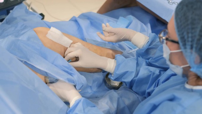 一个熟练的外科团队专注于进行静脉曲张手术来治疗患者的腿部。