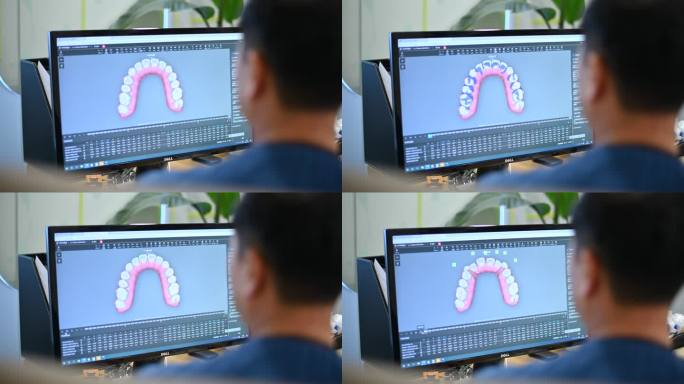 牙科医生在展示3D牙齿状态2