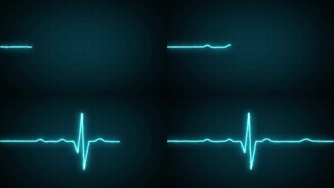心电图霓虹灯心跳脉搏率线。健康和医疗的概念。心电图，脉搏波，心电图和心律