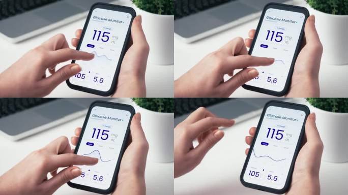 用智能手机应用和远程传感器监测血糖水平。葡萄糖连续监测技术在糖尿病治疗中的应用。