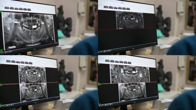 牙科医生在看数字口腔全景片