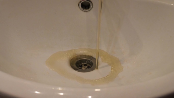 手打开水龙头，肮脏的生锈的水流入家里的水槽。淡水污染问题，供水问题。家里水龙头里的脏水