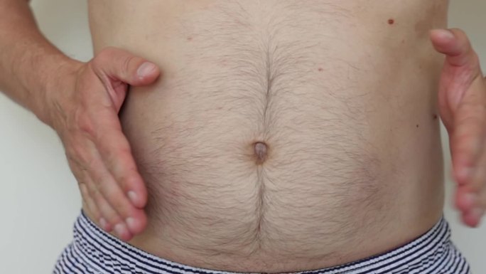 男性腹部超重的裁剪照片。难以辨认的男人，腹部赤裸，毛茸茸的，手抖着，皱巴巴的。过多的腹部脂肪，不健康