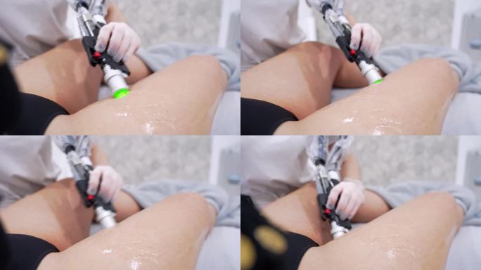 专业美容师在美容院为年轻女性做激光腿部脱毛，身体护理脱毛治疗的特写视频。