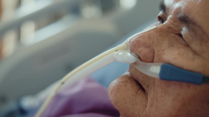亚洲老年成年妇女躺在医院里，鼻子里插着喂食管，身体虚弱，特写