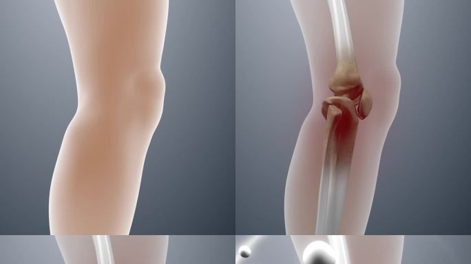 膝盖治疗