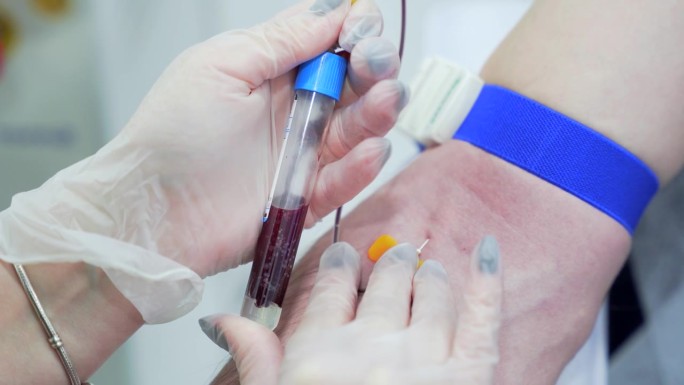 医生取血样分析，手特写。在实验室抽血。在美容诊所进行PRP治疗前采血。