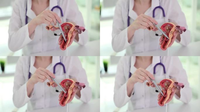 妇科医生在人工子宫特写模型上讲解女性生殖器官解剖