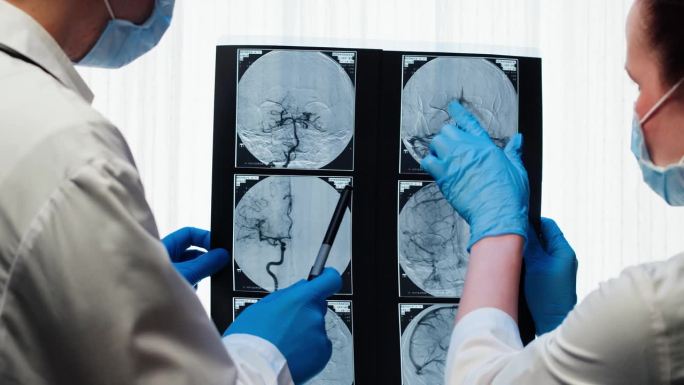 医生检查x光片，脑部核磁共振。头部磁共振图像。治疗师兼护士近距离观察人体血管。先进的身体研究，检查断