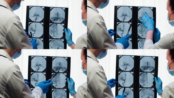医生检查x光片，脑部核磁共振。头部磁共振图像。治疗师兼护士近距离观察人体血管。先进的身体研究，检查断