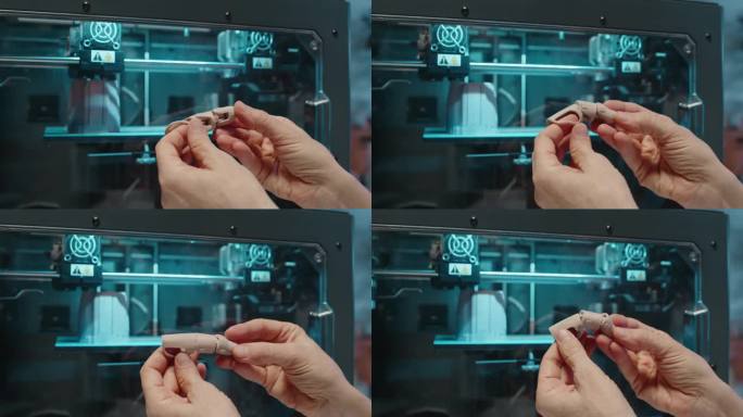 用3D打印机制作的女性手指假肢