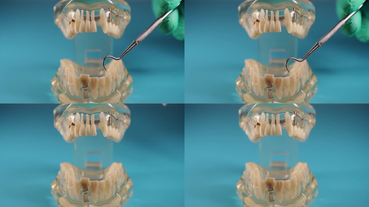牙科医生用牙周探针在病人的下颌模型上检查牙齿是否有龋齿、牙垢和牙根的状况。牙科治疗和预防牙齿的概念，