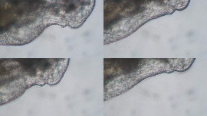 真涡虫、扁形虫