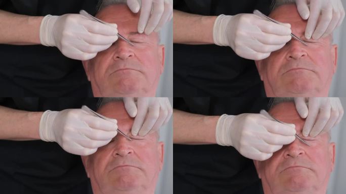 整形外科医生检查时，一名男子的脸部特写。整形手术准备