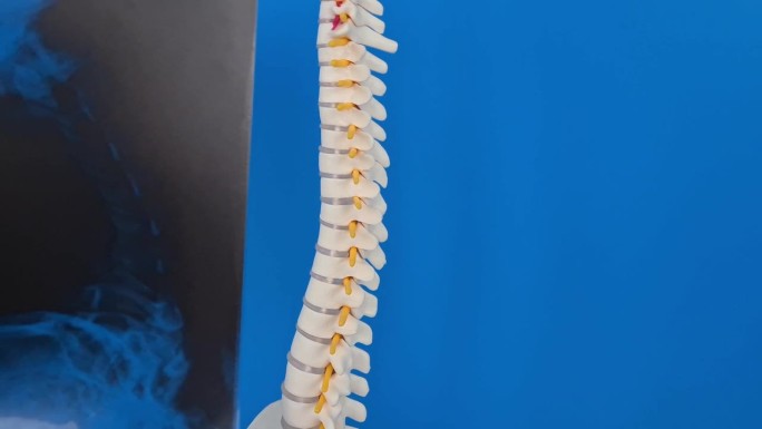 人体脊柱解剖与疾病模型