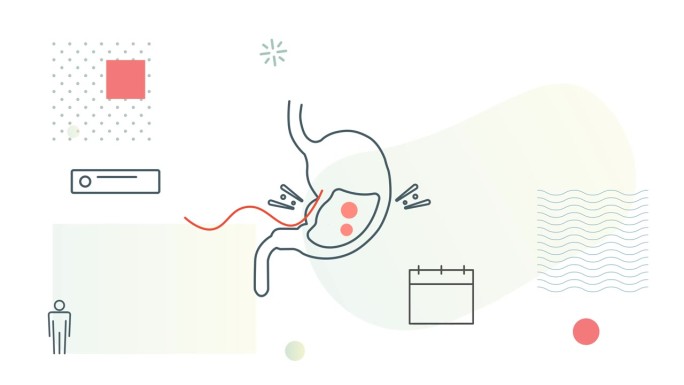 消化问题-访问胃肠病学家-动画图标