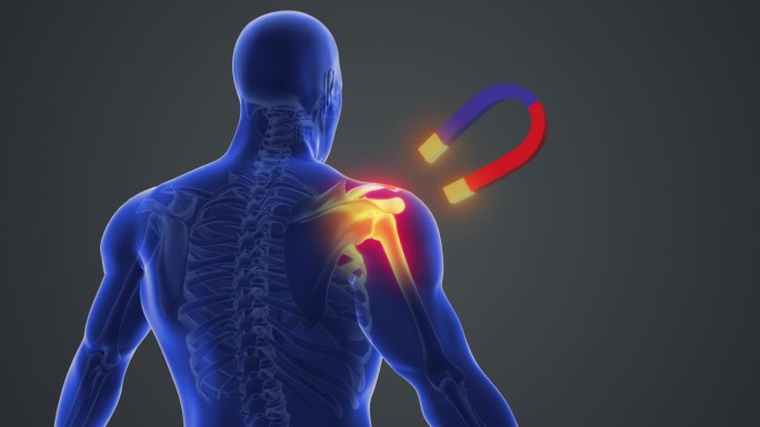 肩关节疼痛的磁疗人体骨骼科技人体三维动画