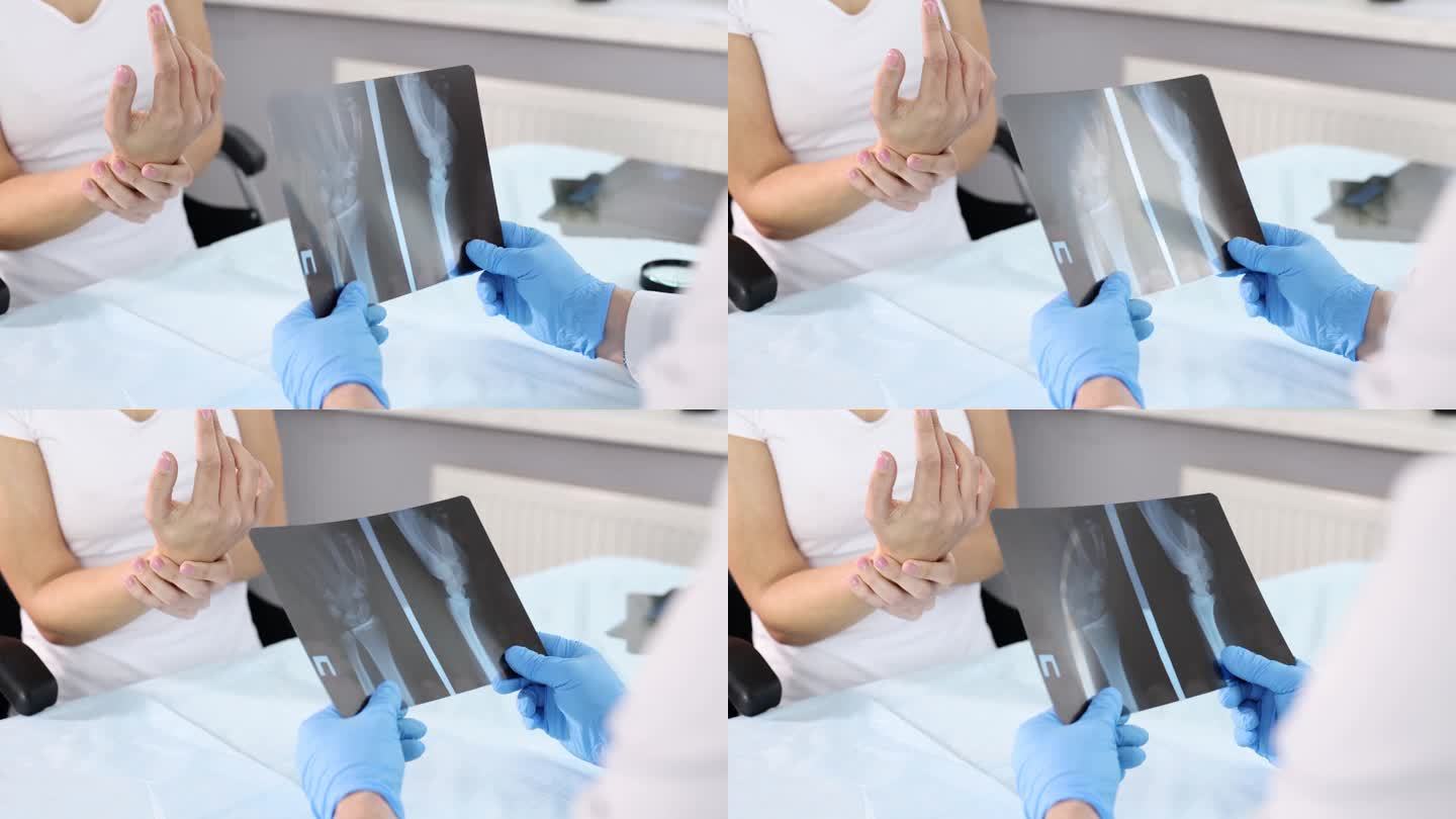 医生看着病人面前的手的x光片4k慢动作电影