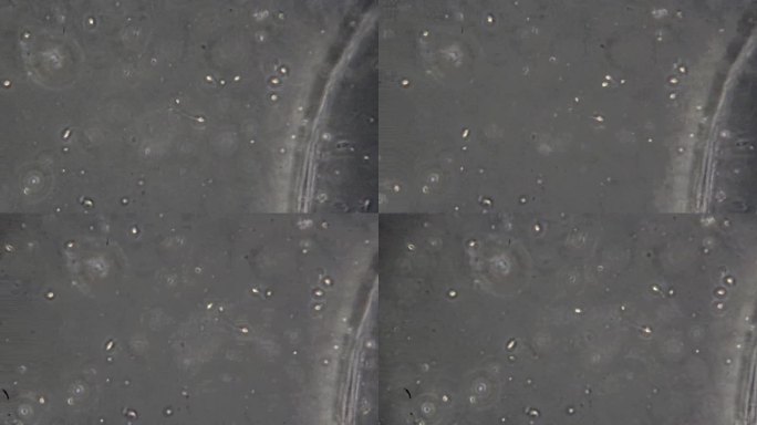 从右向左游动的单个人类精子的平移镜头。