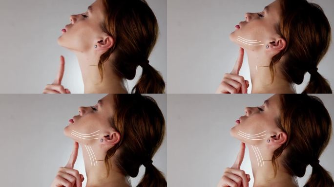 女性面部颈部提拉术