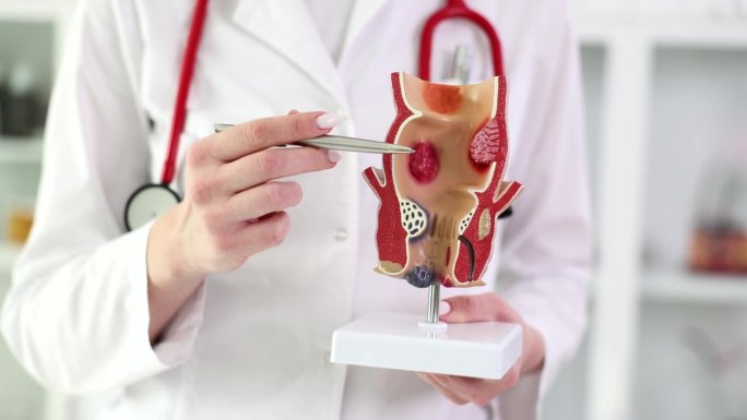 医学教授在人体器官的人造模型上展示直肠疾病特写4k电影慢动作