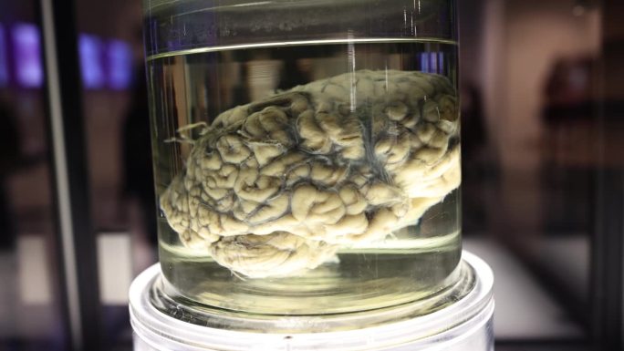 甲醛罐实验室中的人脑