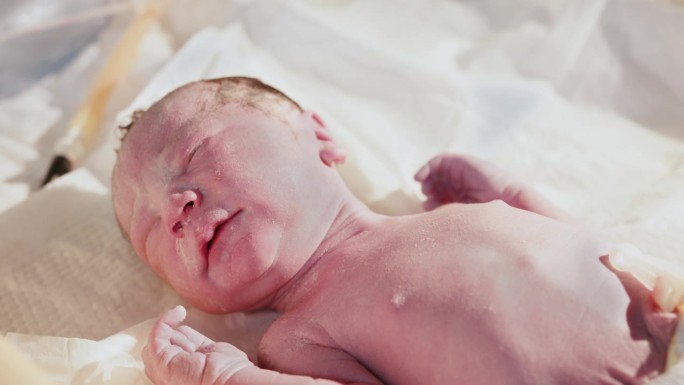 刚出生的婴儿在医院。产科专业儿科医生。医生在新生儿出生的最初几分钟里对其进行检查。医院里的新生儿——