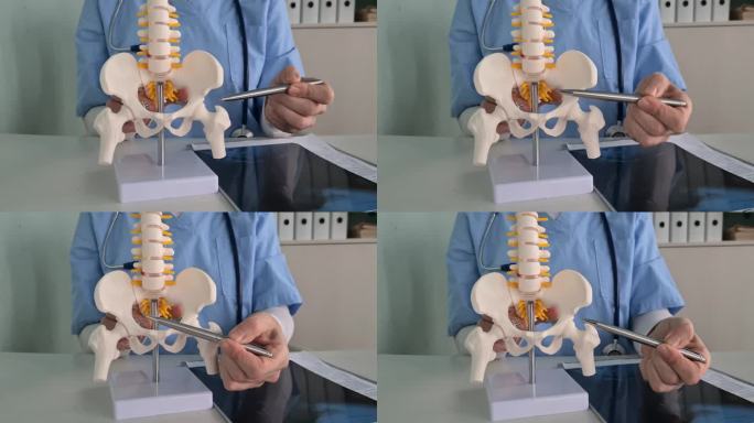 腰椎与骨盆骨及神经根的解剖模型