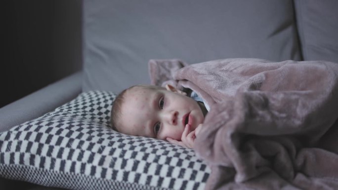 婴儿学步的孩子患水痘躺在床上盖毯子的特写