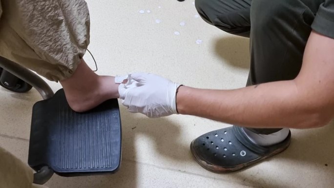 一个物理治疗师从脚上脱下医疗手术的特写演示