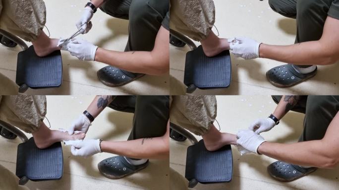 一个物理治疗师从脚上脱下医疗手术的特写演示