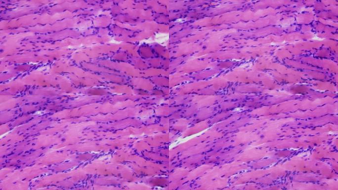 健美的肌肉。合成代谢和生长激素的作用。显微镜下的人体骨骼肌组织，放大400倍。纵切面。对焦和移动流畅