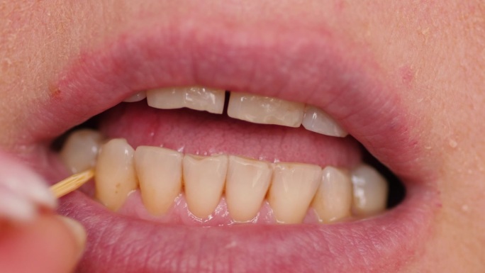 一个女人用木制牙签剔漂亮的直牙的特写。口腔卫生，预防龋齿。女性的口腔牙齿
