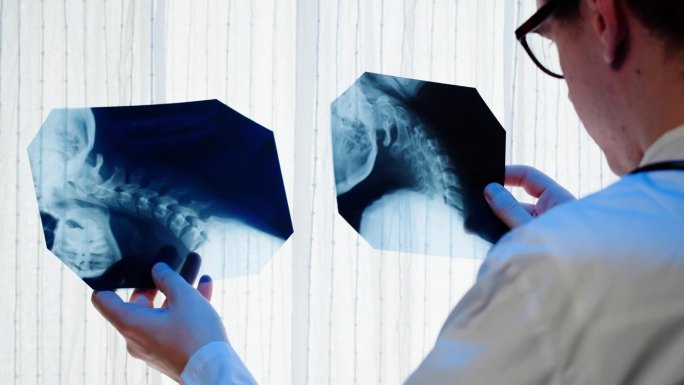 医生检查颈部x光特写。脊柱、头颅的磁共振成像。男治疗师正在看脊椎骨骼的x光片。医疗保健和医药概念。