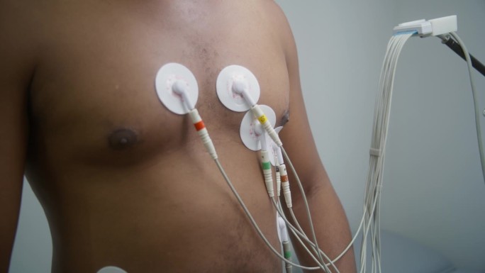 女心脏病专家给病人装上心电图传感器