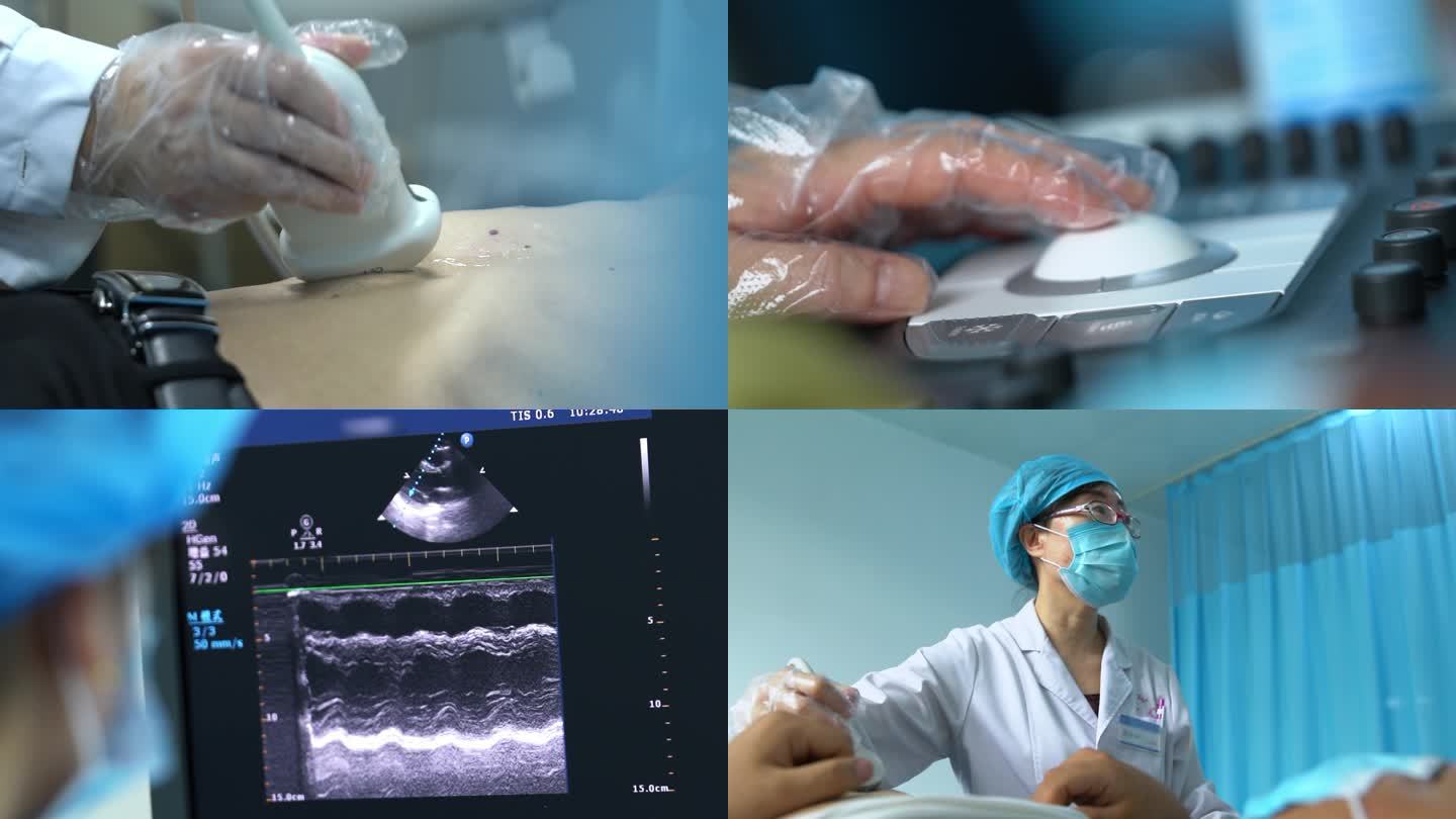 腹腔镜B超影像检测