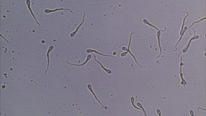 猪精液 品质检查 显微镜下 精子运动情况