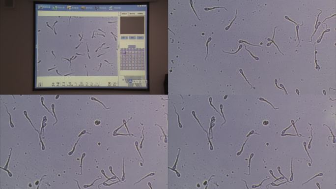 猪精液 品质检查 显微镜下 精子运动情况