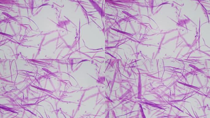 显微镜下的人体平滑肌纤维束，是非横纹肌。平滑肌由粗细细丝组成，这些细丝没有排列成肌节，因此呈非条纹状