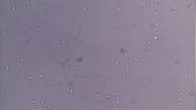 猪精液品质检查 显微镜下精子运动情况