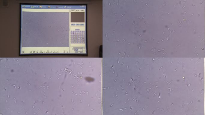 猪精液品质检查 显微镜下精子运动情况