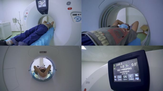 64排螺旋CT检查身体