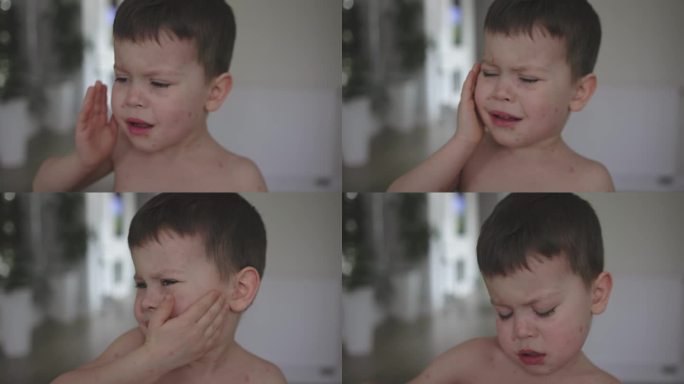 男男孩小孩长水痘，脸上长粉刺，哭闹紧张，抓挠皮肤