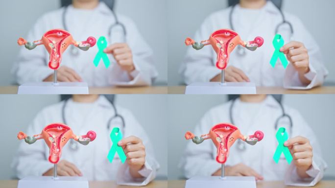 一月子宫颈癌宣传月，医生手持子宫和卵巢模型的蓝绿色丝带。子宫颈、子宫内膜异位症、子宫切除术、子宫、生