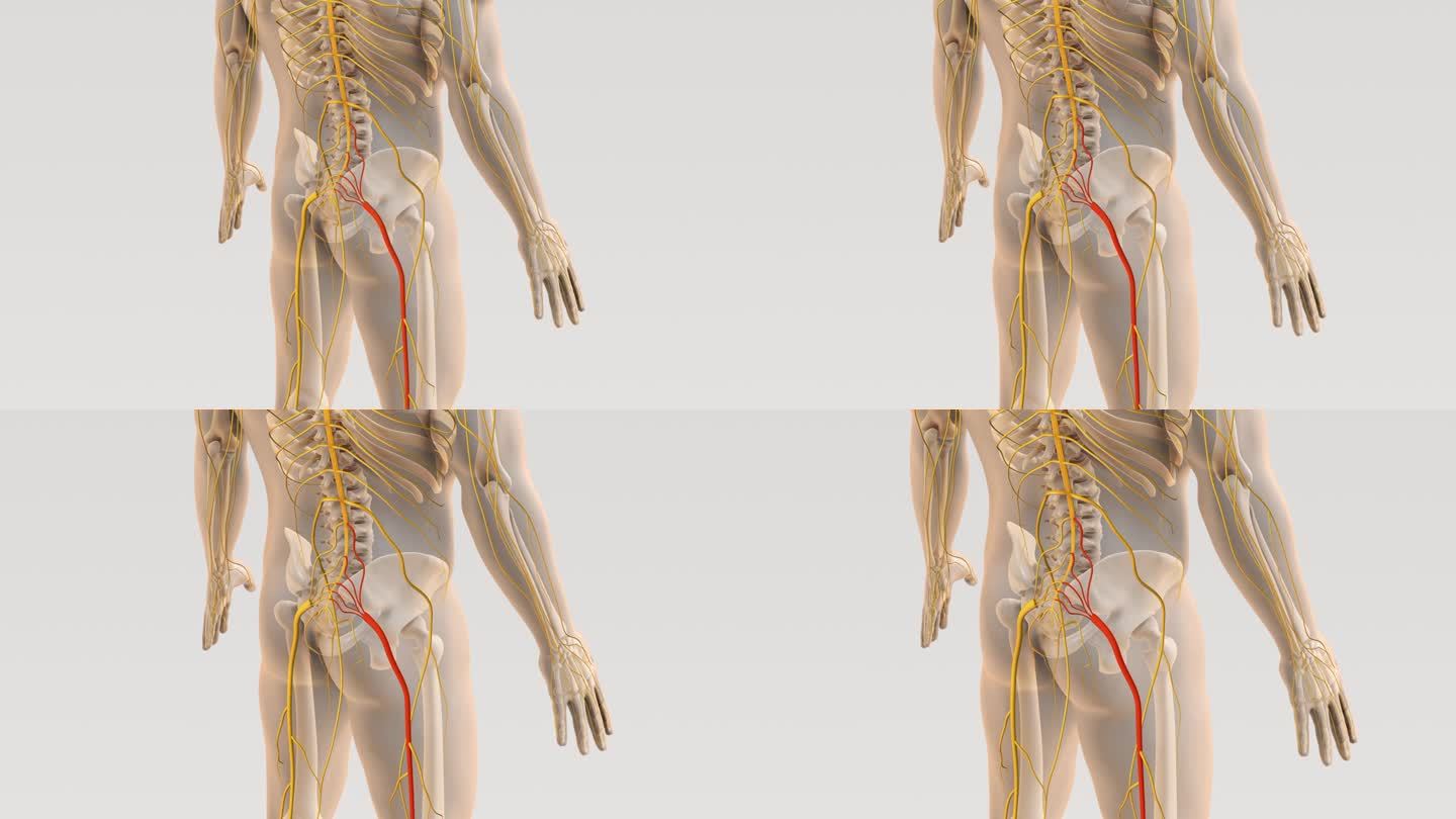 坐骨神经痛和脊柱神经痛的医学概念