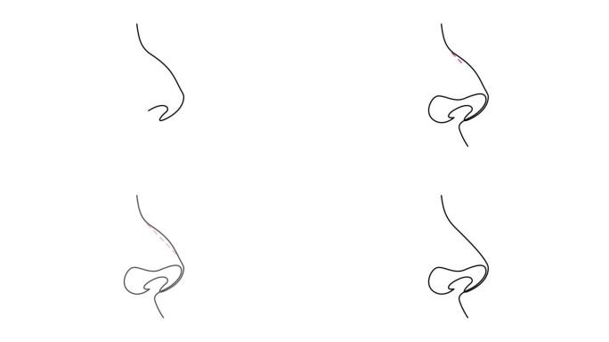 通过连续的一条线绘制的鼻子整形手术的动画自绘图。鼻整形前后。全长单线动画。